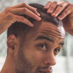 A Guide To Hair Transplants For Bald People