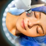 Revitalize Your Skin: Exploring The Benefits Of Laser Treatment For Pigmentation